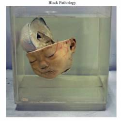 Black Pathology : The Final Session